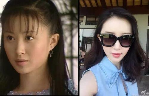 为什么明星是尖下巴,美丽背后的秘密